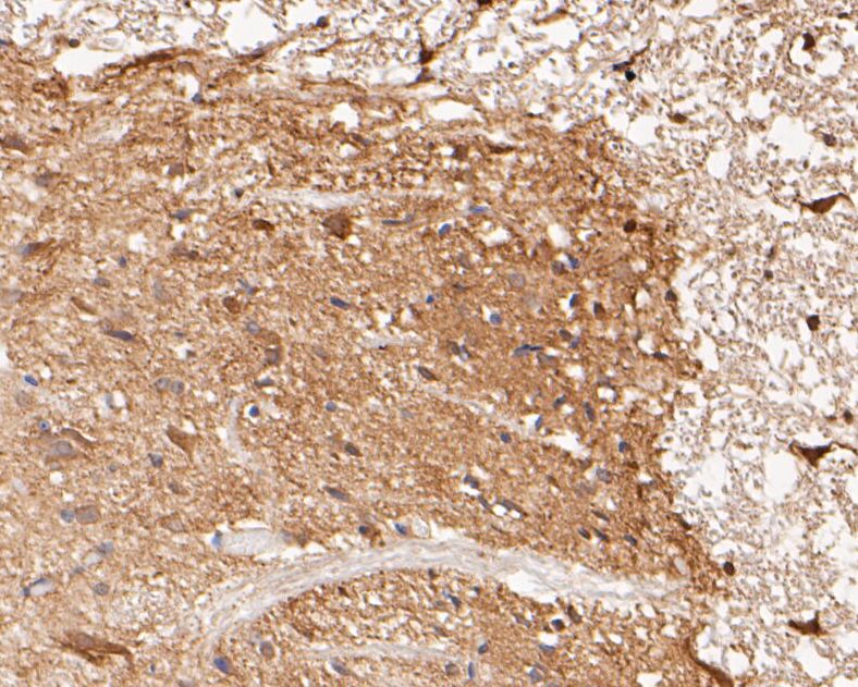 Fig4: Immunohistochemical analysis of paraffin-embedded rat spinal cord tissue using anti-KCNK18 antibody. The section was pre-treated using heat mediated antigen retrieval with Tris-EDTA buffer (pH 8.0-8.4) for 20 minutes.The tissues were blocked in 5% BSA for 30 minutes at room temperature, washed with ddH2O and PBS, and then probed with the primary antibody ( 1/50) for 30 minutes at room temperature. The detection was performed using an HRP conjugated compact polymer system. DAB was used as the chromogen. Tissues were counterstained with hematoxylin and mounted with DPX.