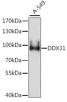 Western blot - DDX31 Polyclonal Antibody 