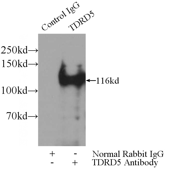 IP Result of anti-TDRD5 (IP:Catalog No:115929, 5ug; Detection:Catalog No:115929 1:300) with mouse testis tissue lysate 2800ug.