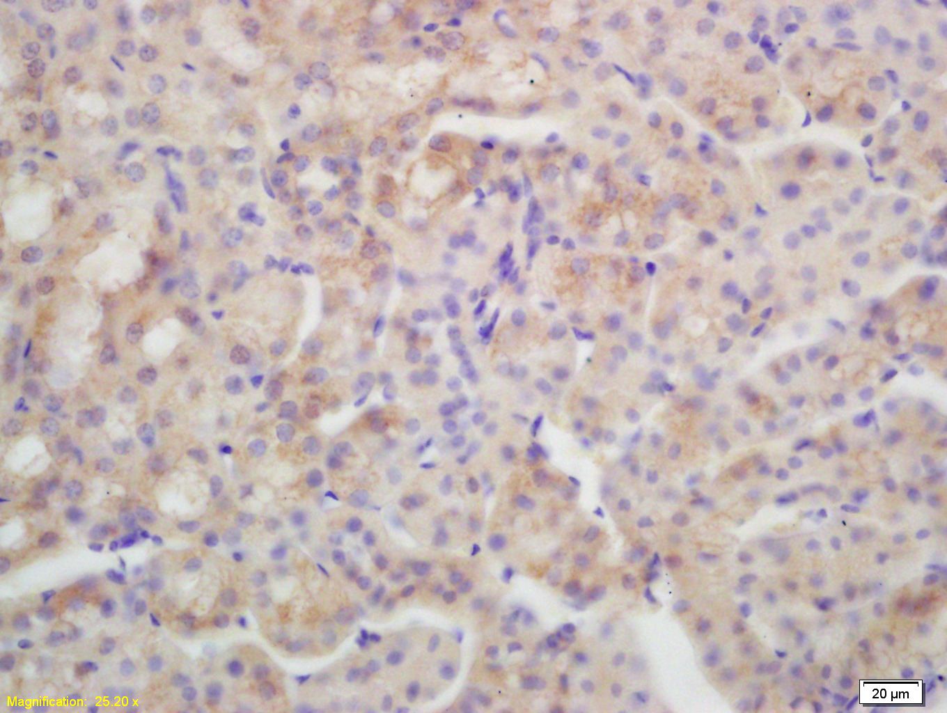 Fig3: Tissue/cell: mouse kidney tissue; 4% Paraformaldehyde-fixed and paraffin-embedded;; Antigen retrieval: citrate buffer ( 0.01M, pH 6.0 ), Boiling bathing for 15min; Block endogenous peroxidase by 3% Hydrogen peroxide for 30min; Blocking buffer (normal goat serum,C-0005) at 37℃ for 20 min;; Incubation: Anti-AQP4 Polyclonal Antibody, Unconjugated 1:200, overnight at 4℃, followed by conjugation to the secondary antibody(SP-0023) and DAB(C-0010) staining