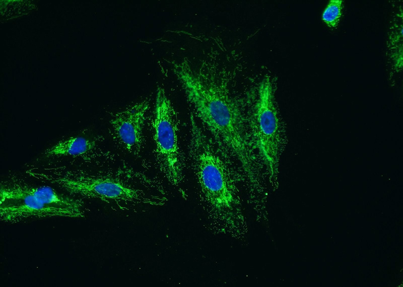 Immunofluorescent analysis of A549 cells using Catalog No:111987(KIAA0907 Antibody) at dilution of 1:25 and Alexa Fluor 488-congugated AffiniPure Goat Anti-Rabbit IgG(H+L)