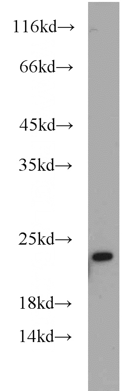 human brain tissue were subjected to SDS PAGE followed by western blot with Catalog No:108370(BBS3 antibody) at dilution of 1:500