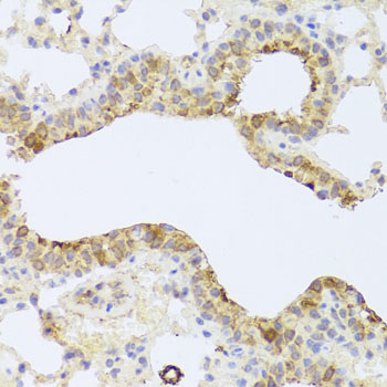 Immunohistochemistry - PDK3 Polyclonal Antibody 