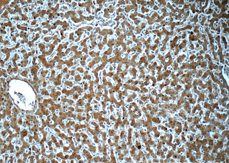 Immunohistochemistry of paraffin-embedded human liver tissue slide using Catalog No:113096(NEDD4 Antibody) at dilution of 1:50