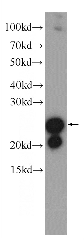 mouse colon tissue were subjected to SDS PAGE followed by western blot with Catalog No:116333(TAGLN Antibody) at dilution of 1:1000