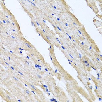 Immunohistochemistry - RCN2 Polyclonal Antibody 