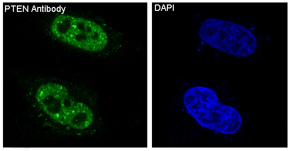 Immunofluorescent analysis of Hela cells, using PTEN Antibody.