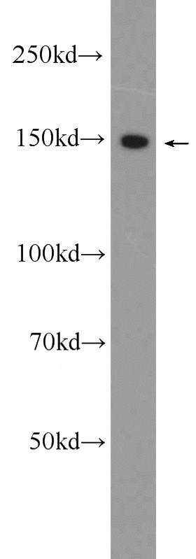 HepG2 cells were subjected to SDS PAGE followed by western blot with Catalog No:109523(CPS1 Antibody) at dilution of 1:1000