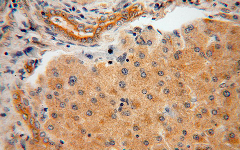 Immunohistochemical of paraffin-embedded human liver using Catalog No:107674(APEH antibody) at dilution of 1:100 (under 40x lens)