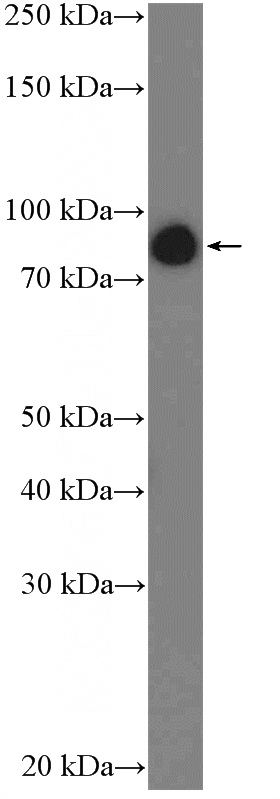 HeLa cells were subjected to SDS PAGE followed by western blot with Catalog No:110936(Gelsolin Antibody) at dilution of 1:1000