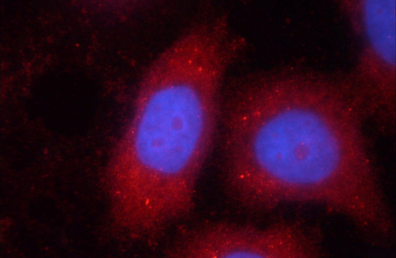 Immunofluorescent analysis of HeLa cells using Catalog No:115688(STAT3 Antibody) at dilution of 1:25 and Rhodamine-Goat anti-Rabbit IgG