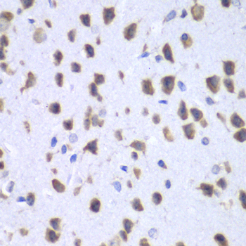 Immunohistochemistry - UPF1 Polyclonal Antibody 