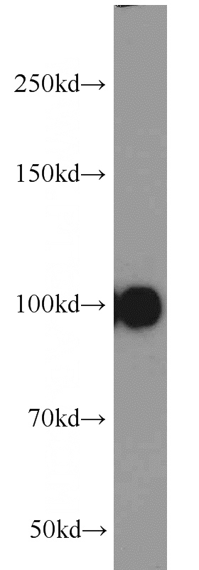 human serum tissue were subjected to SDS PAGE followed by western blot with Catalog No:111948(ITIH3 antibody) at dilution of 1:1000