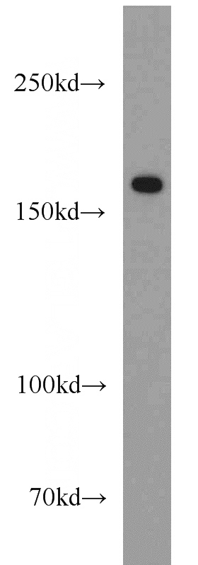 human placenta tissue were subjected to SDS PAGE followed by western blot with Catalog No:109441(COL16A1-Specific antibody) at dilution of 1:1500