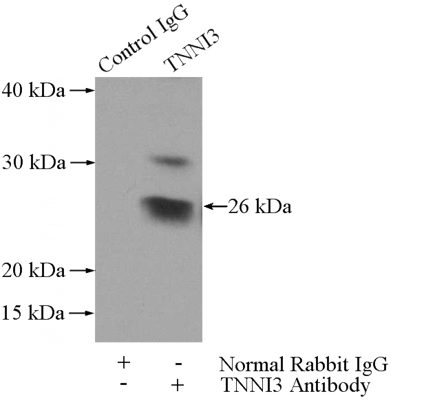 IP Result of anti-TNNI3 (IP:Catalog No:108859, 3ug; Detection:Catalog No:108859 1:700) with mouse heart tissue lysate 4000ug.