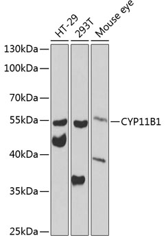 Western blot - CYP11B1 Polyclonal Antibody 