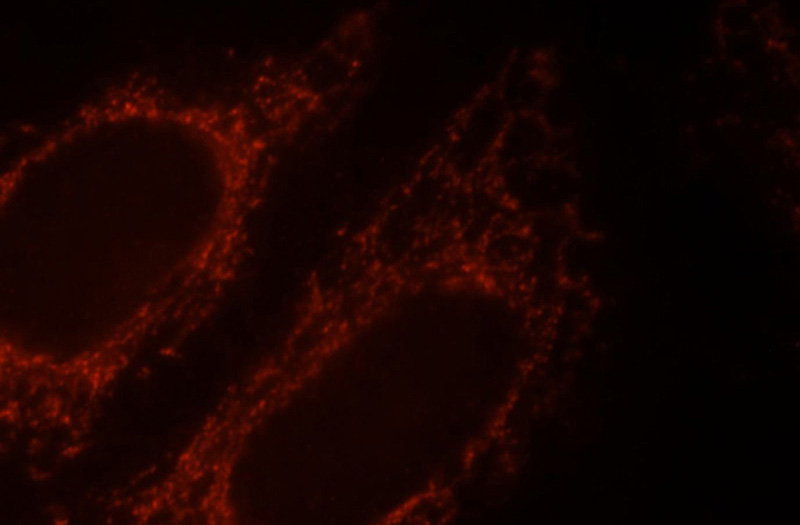 Immunofluorescent analysis of HepG2 cells, using SNCB antibody Catalog No:115451 at 1:25 dilution and Rhodamine-labeled goat anti-rabbit IgG (red).