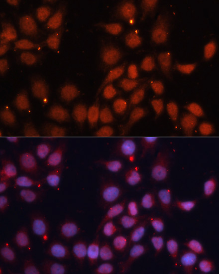Immunofluorescence - CDK11B Polyclonal Antibody 