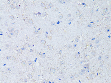 Immunohistochemistry - RYR2 Polyclonal Antibody 
