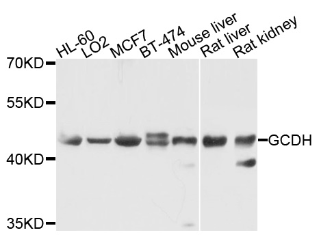 Western blot - GCDH Polyclonal Antibody 