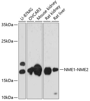 Western blot - NME1-NME2 Polyclonal Antibody 