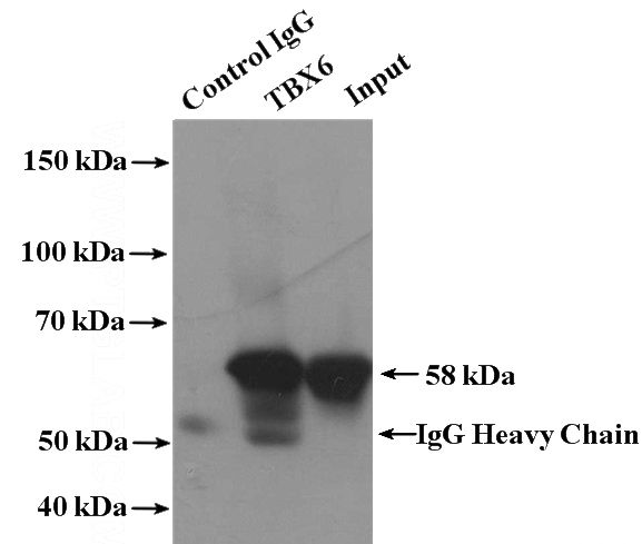 IP Result of anti-TBX6 (IP:Catalog No:115894, 4ug; Detection:Catalog No:115894 1:500) with human placenta tissue lysate 2800ug.