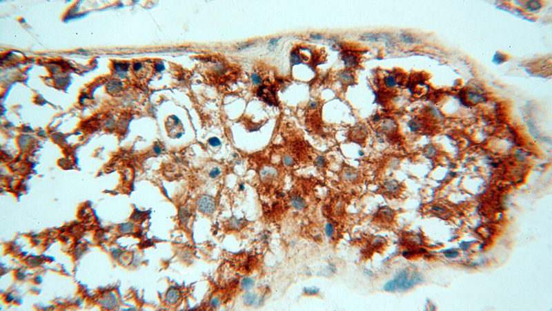 Immunohistochemical of paraffin-embedded human testis using Catalog No:117300(tubulin-Alpha antibody) at dilution of 1:50 (under 40x lens)