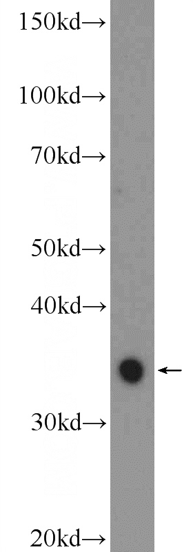 RAW 264.7 cells were subjected to SDS PAGE followed by western blot with Catalog No:107816(ABHD6 Antibody) at dilution of 1:300