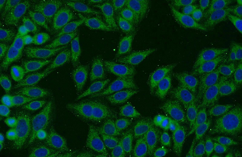 Immunofluorescent analysis of HepG2 cells using Catalog No:115362(SLC27A2 Antibody) at dilution of 1:25 and Alexa Fluor 594-congugated AffiniPure Goat Anti-Rabbit IgG(H+L)
