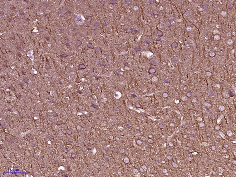 Fig3: Paraformaldehyde-fixed, paraffin embedded (Mouse brain); Antigen retrieval by boiling in sodium citrate buffer (pH6.0) for 15min; Block endogenous peroxidase by 3% hydrogen peroxide for 20 minutes; Blocking buffer (normal goat serum) at 37℃ for 30min; Antibody incubation with (beta I Tubulin) Monoclonal Antibody, Unconjugated (175095# 5F7) at 1:400 overnight at 4℃, followed by operating according to SP Kit(Mouse) (sp-0024) instructionsand DAB staining.