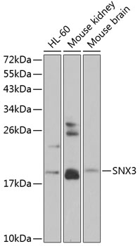 Western blot - SNX3 Polyclonal Antibody 