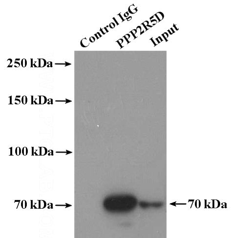 IP Result of anti-PPP2R5D (IP:Catalog No:114106, 4ug; Detection:Catalog No:114106 1:400) with Y79 cells lysate 2000ug.