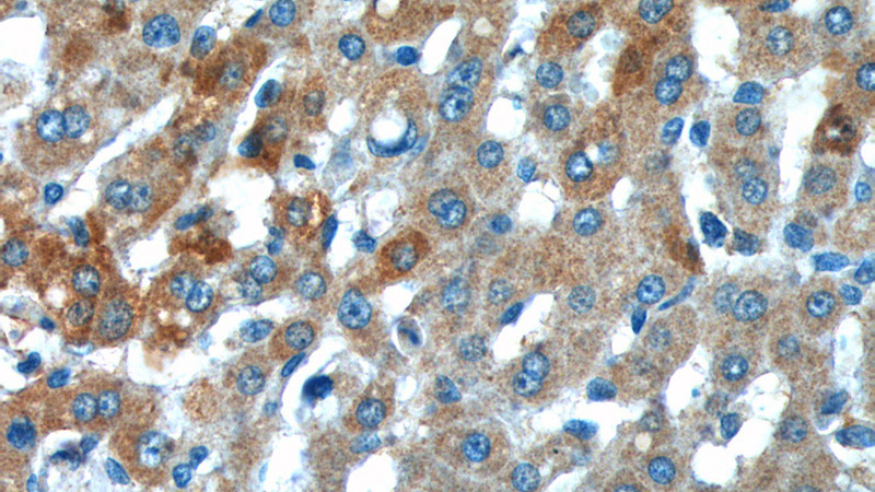 Immunohistochemistry of paraffin-embedded human liver tissue slide using Catalog No:116771(VPS13B Antibody) at dilution of 1:200 (under 40x lens).