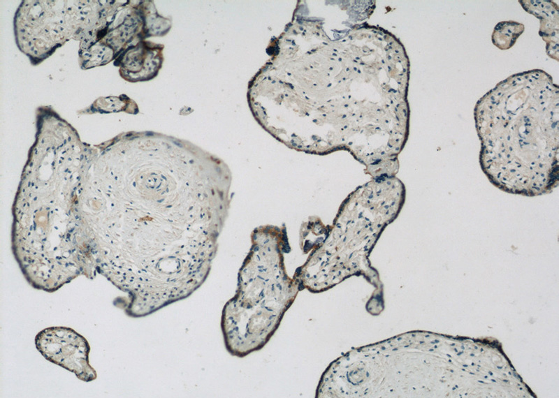 Immunohistochemistry of paraffin-embedded human placenta slide using Catalog No:107697(ACSL4 Antibody) at dilution of 1:50