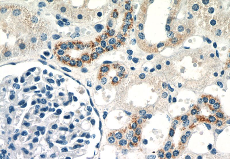 Immunohistochemistry of paraffin-embedded human kidney slide using Catalog No:112034(GLS Antibody) at dilution of 1:50