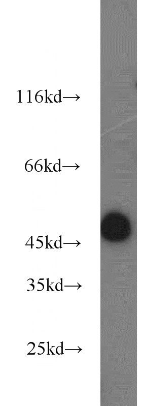 mouse testis tissue were subjected to SDS PAGE followed by western blot with Catalog No:115642(SPRED2 antibody) at dilution of 1:1000