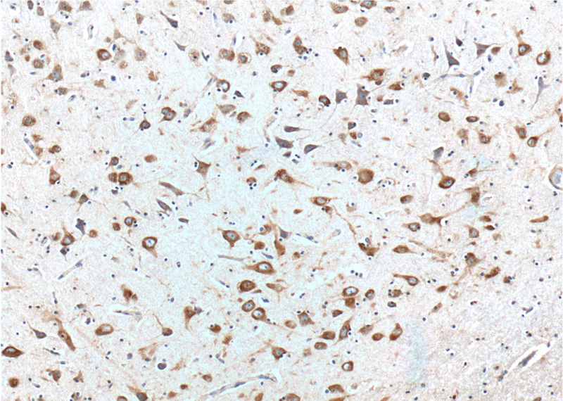 Immunohistochemistry of paraffin-embedded human brain tissue slide using (Peripherin Antibody) at dilution of 1:100 (under 10x lens).