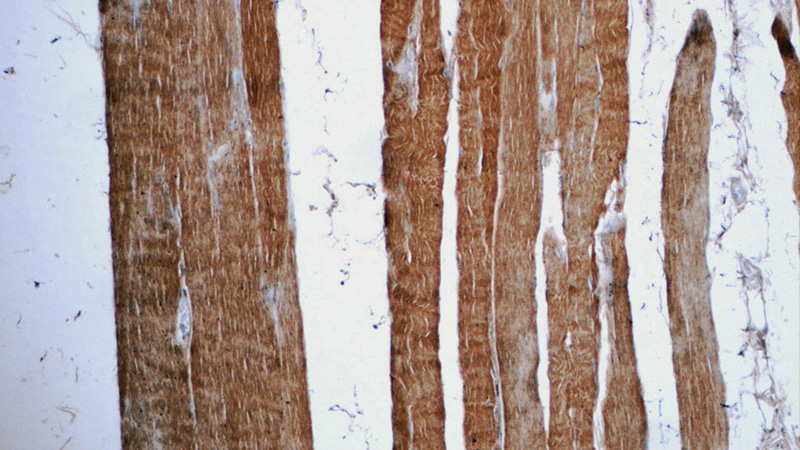 Immunohistochemistry of paraffin-embedded human skeletal muscle tissue slide using Catalog No:110166(MAPRE3 Antibody) at dilution of 1:50 (under 10x lens)