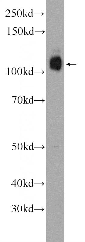 mouse testis tissue were subjected to SDS PAGE followed by western blot with Catalog No:115663(SRBD1 Antibody) at dilution of 1:300