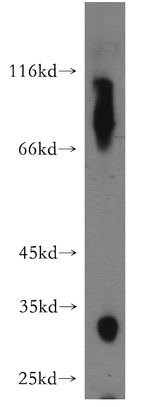 human liver tissue were subjected to SDS PAGE followed by western blot with Catalog No:111548(HSD17B6 antibody) at dilution of 1:200
