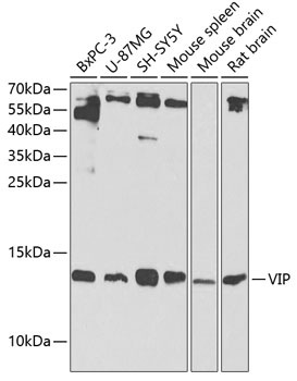 Western blot - VIP Polyclonal Antibody 