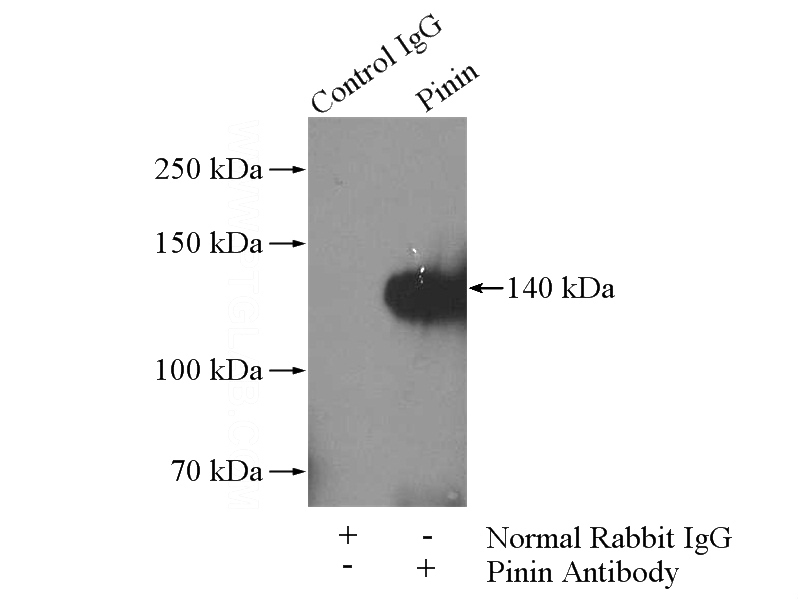 IP Result of anti-PNN (IP:Catalog No:113909, 4ug; Detection:Catalog No:113909 1:300) with HeLa cells lysate 520ug.