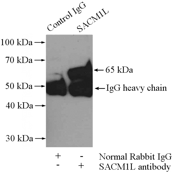 IP Result of anti-SACM1L (IP:Catalog No:115041, 4ug; Detection:Catalog No:115041 1:1000) with mouse kidney tissue lysate 4000ug.