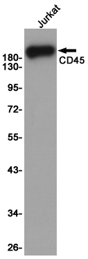 Western blot detection of CD45 in Jurkat cell lysates using CD45 (8C1) Mouse mAb(1:1000 diluted).Predicted band size:147KDa.Observed band size:180 to 240KDa.