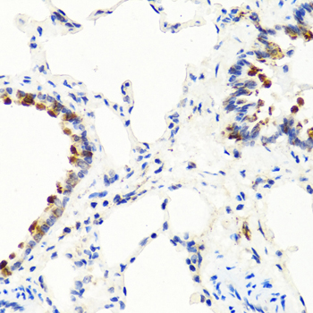 Immunohistochemistry - NTF3 Polyclonal Antibody 