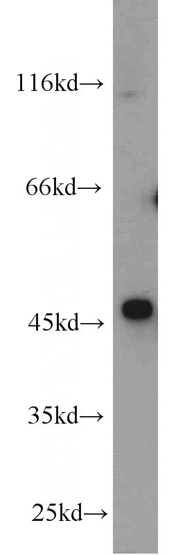 Jurkat cells were subjected to SDS PAGE followed by western blot with Catalog No:113530(OXTR antibody) at dilution of 1:1000