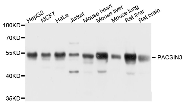 Western blot - PACSIN3 Polyclonal Antibody 