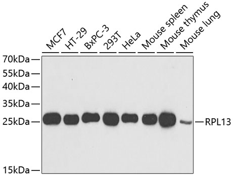 Western blot - RPL13 Polyclonal Antibody 