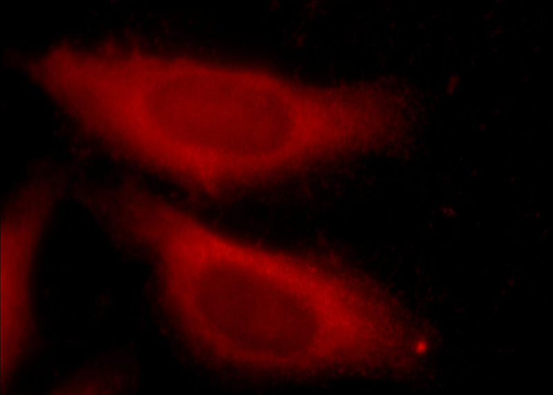 Immunofluorescent analysis of HepG2 cells using Catalog No:115027(SDCCAG3 Antibody) at dilution of 1:50 and N/A