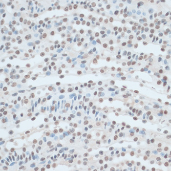 Immunohistochemistry - ZNF433 Polyclonal Antibody 